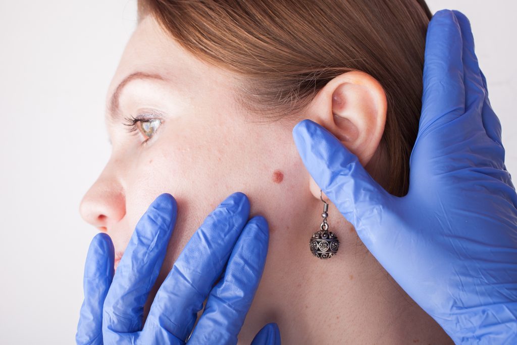 Skin surgery