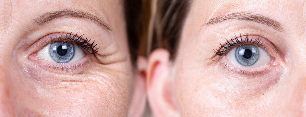 Face and neck aesthetic surgery
