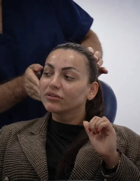 Facial cosmetic plastic surgery at Allura Medical