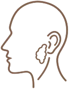 Superficial or total parotidectomy salivary gland surgery illustration