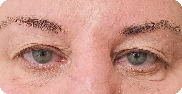 Before: Before and after treatment