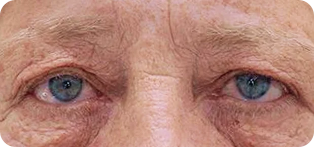 Before: Before and after treatment