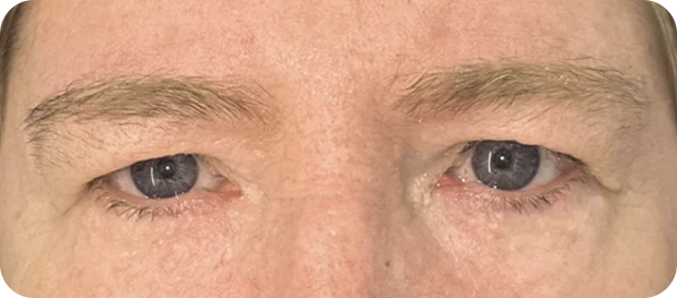 Before: Before and after treatment