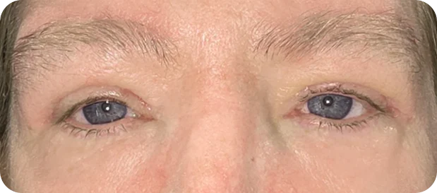 After: Before and after treatment