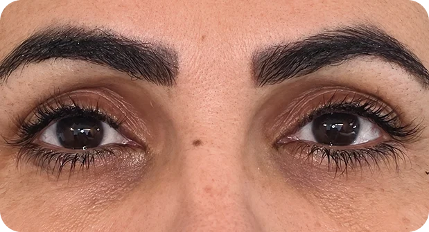 After: Before and after treatment