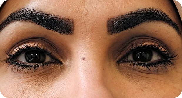 Before: Before and after treatment