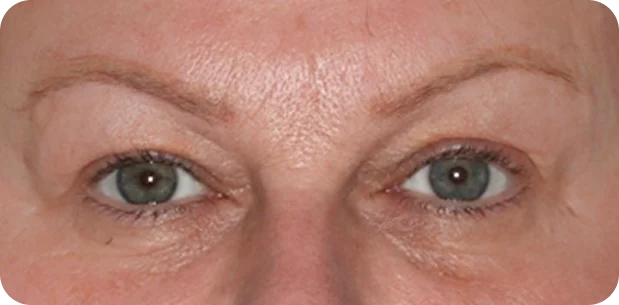 Before: Before and after treatment