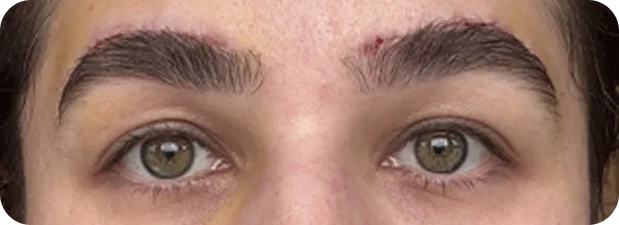 After: Before and after treatment