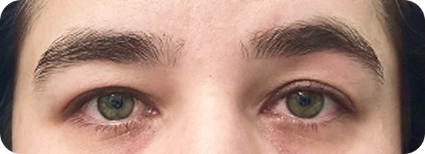 Before: Before and after treatment