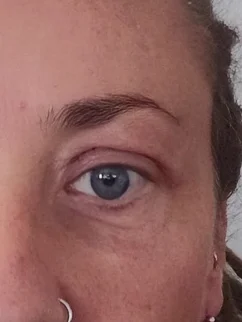 After: Before and after treatment
