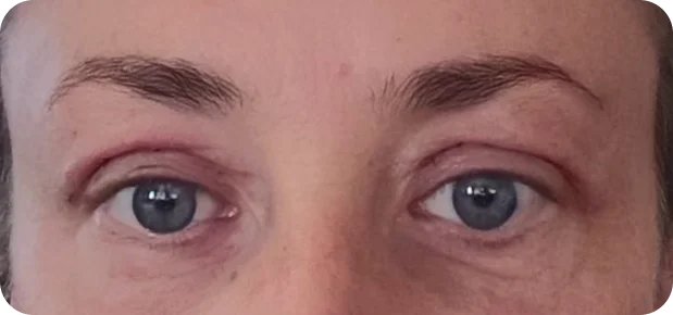 After: Before and after treatment
