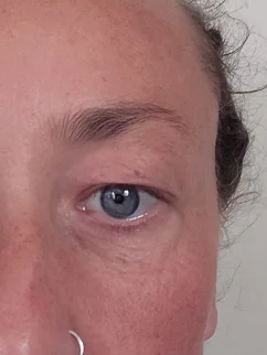 Before: Before and after treatment