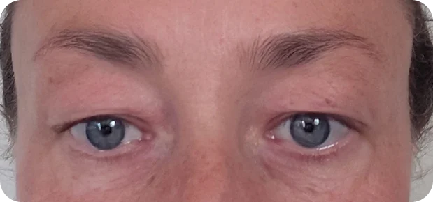 Before: Before and after treatment