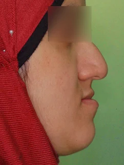 Before: Before and after treatment