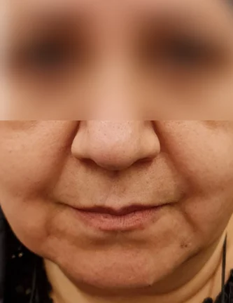Before: Before and after treatment