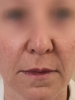 Before: Before and after treatment