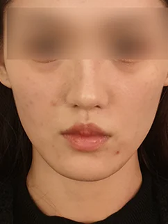 Before: Before and after treatment