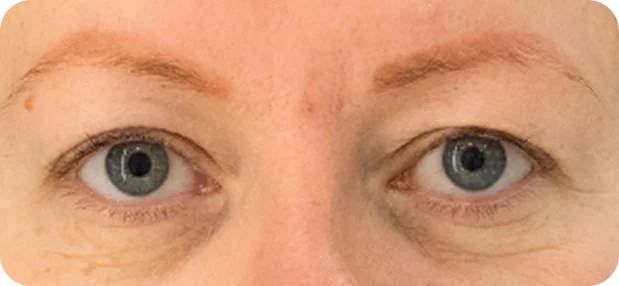 Before: Before and after treatment