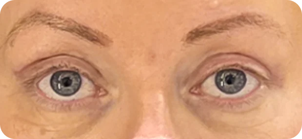After: Before and after treatment