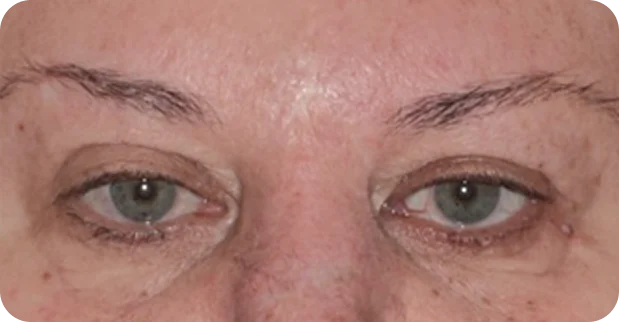 After: Before and after treatment