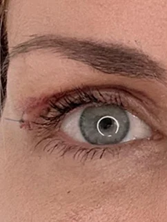 After: Before and after treatment